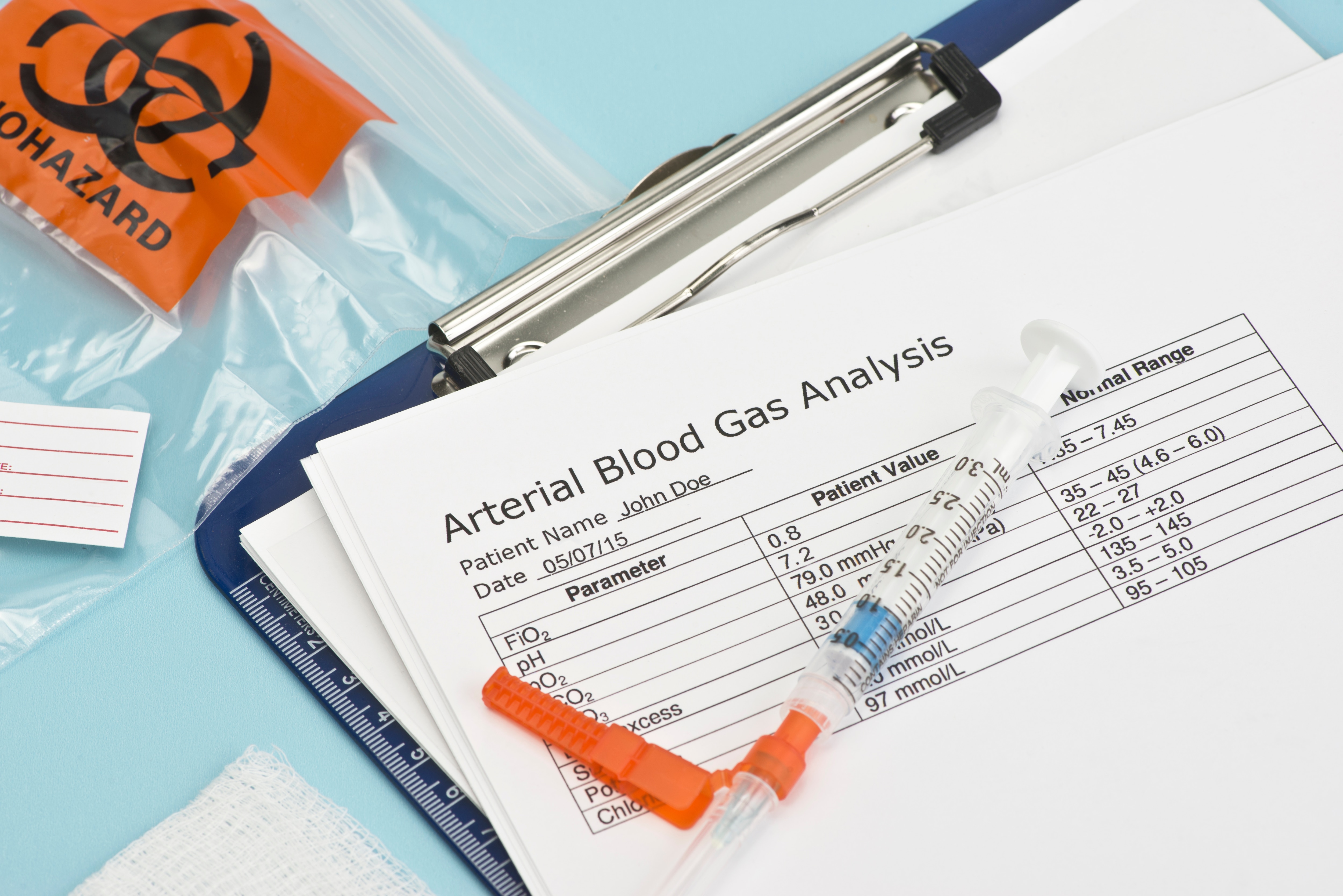 AX_CORP_AdobeStock_Blood-Gas-Analysis_IM_85613843_Preview.jpeg